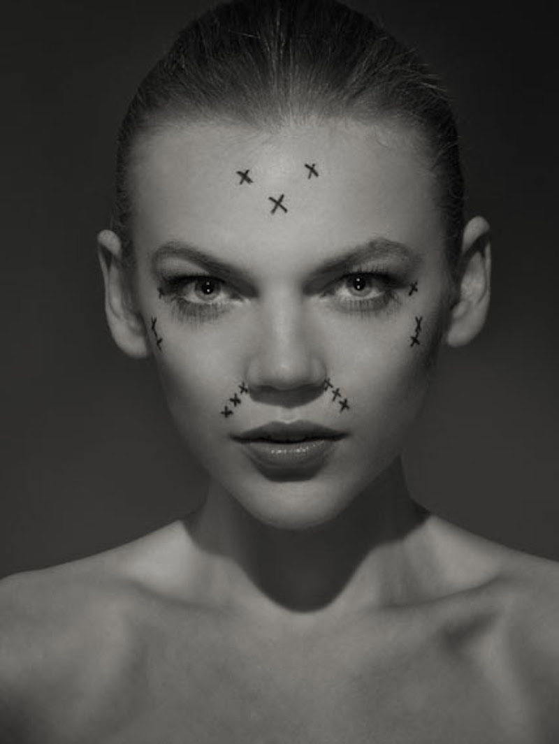 Patient- A.A., age 25 © Marc Erwin Babe