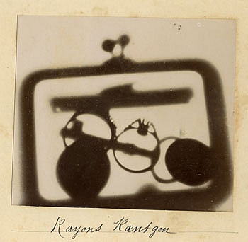 Mandelbaum Ann