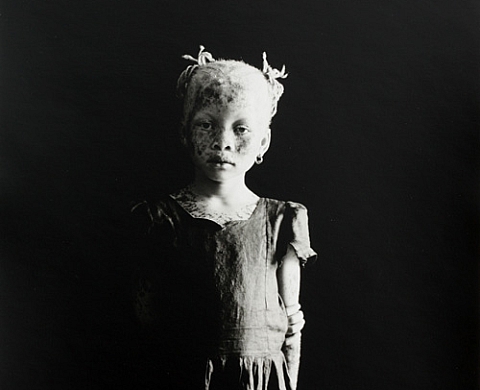 Skin Curated by Giovanna Calvenzi, Mario Peliti and Laura Serani