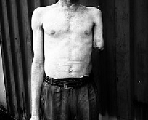 Franck Vogel - Albinos : Massacres en Tanzanie Franck Vogel - Albinos : Massacres en Tanzanie