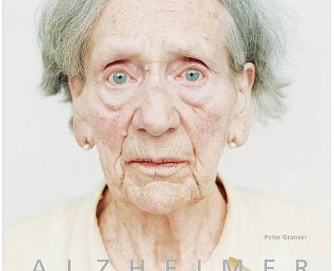 Alzheimer - Peter Granser Alzheimer - Peter Granser