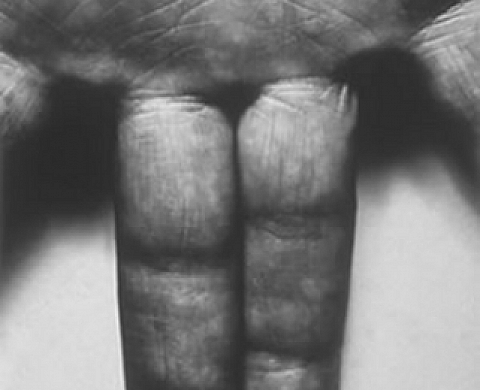 Self Portrait / une exposition de photographies par John COPLANS