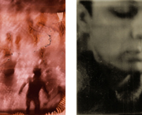 Vivre avec la maladie, et oublier