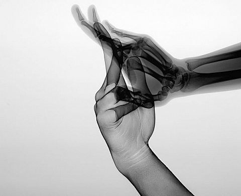 Hajdu Jozsef, Stane Jagodic, Marc Ferrante - X-Ray Men 