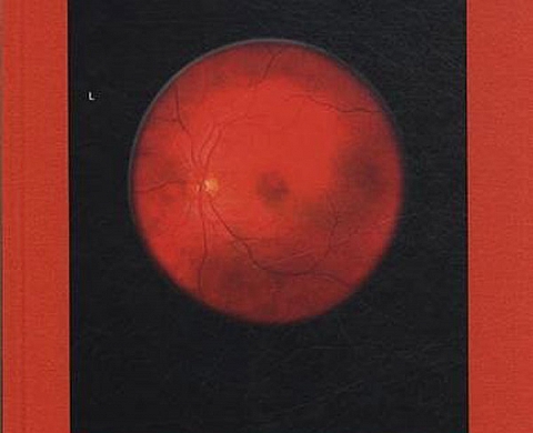 Retinal Shift - Mikhael Subotzky Retinal Shift - Mikhael Subotzky