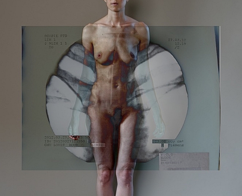 L'association Skin propose une exposition collective pour la lutte contre le cancer du sein