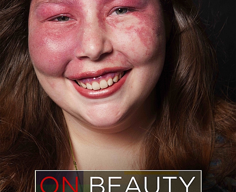 « On Beauty », le docu-photo sur la beauté différente