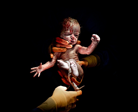Christian Berthelot en lice pour le « Medicine Unboxed Creative Prize 2015 »