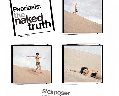 Ralf Tooten - Psoriasis : the naked truth Ralf Tooten - Psoriasis : the naked truth